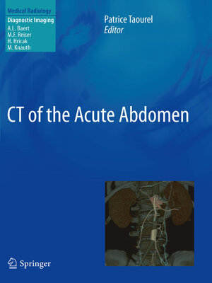 cover image of CT of the Acute Abdomen